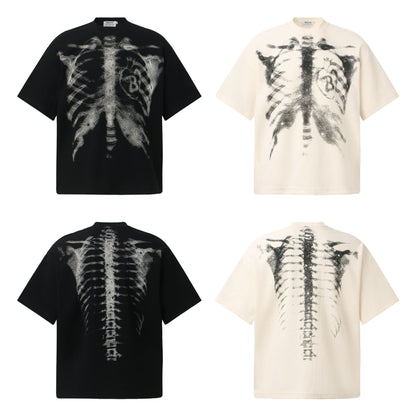 Xray Tees