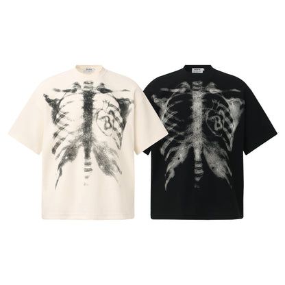 Xray Tees