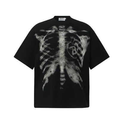 Xray Tees